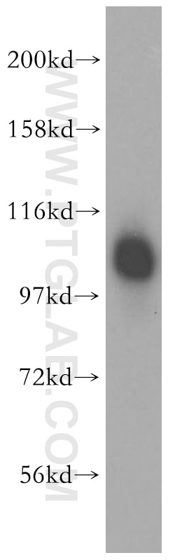Western Blot (WB) analysis of Jurkat cells using FAM29A Polyclonal antibody (16933-1-AP)