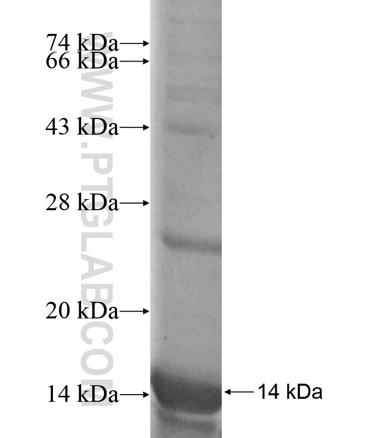 FAM30A fusion protein Ag18421 SDS-PAGE