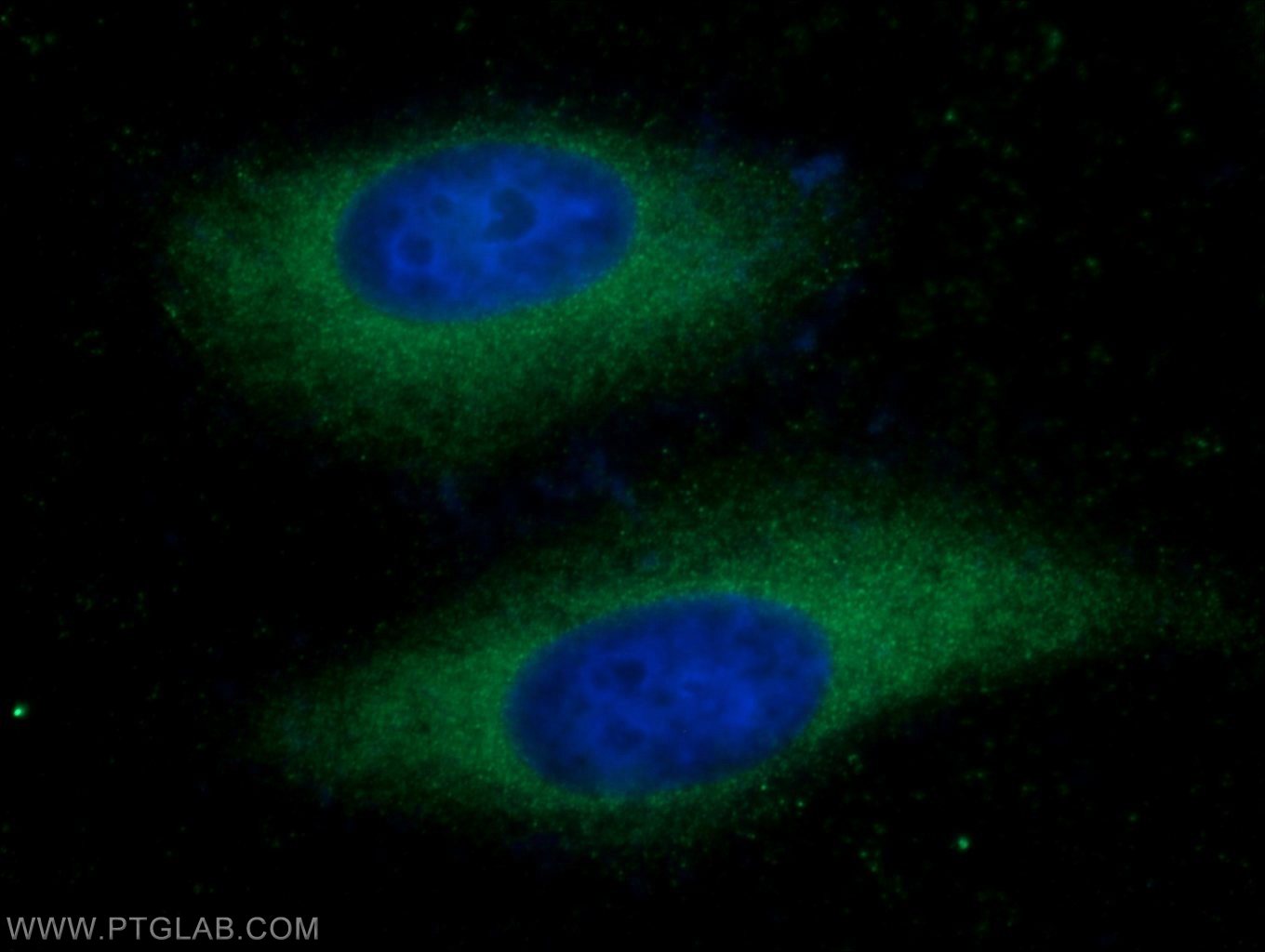 IF Staining of HeLa using 25752-1-AP