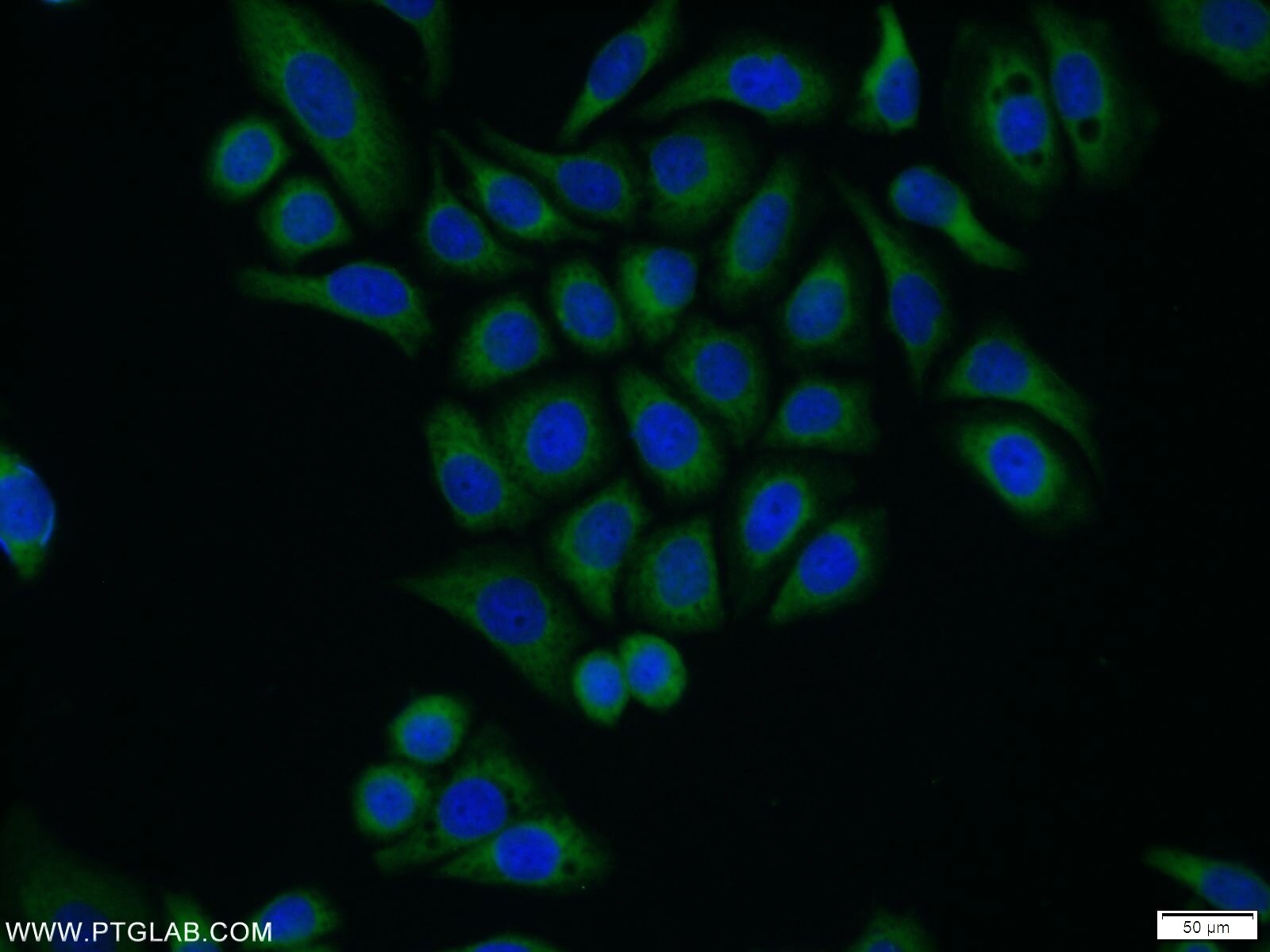 IF Staining of PC-3 using 25752-1-AP