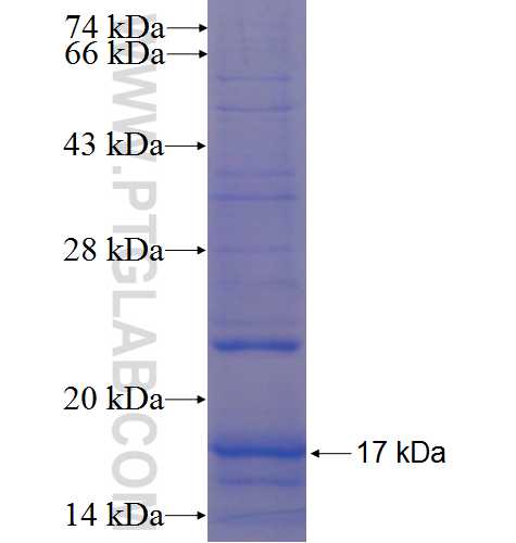 FAM36A fusion protein Ag22520 SDS-PAGE