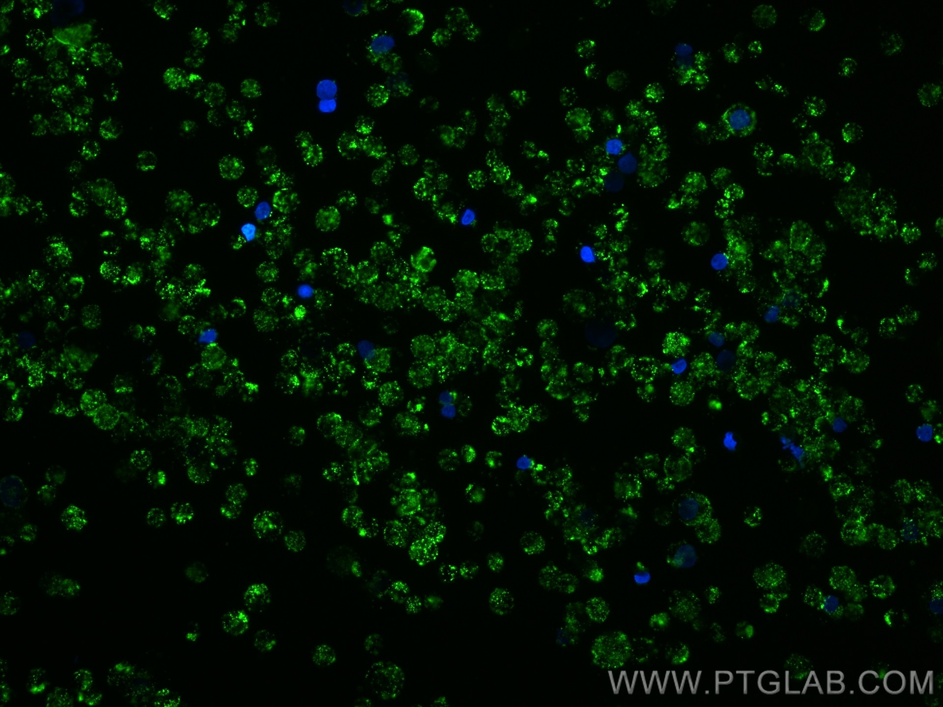 Immunofluorescence (IF) / fluorescent staining of THP-1 cells using Piezo1 (extracellular domain) Polyclonal antibody (15939-1-AP)