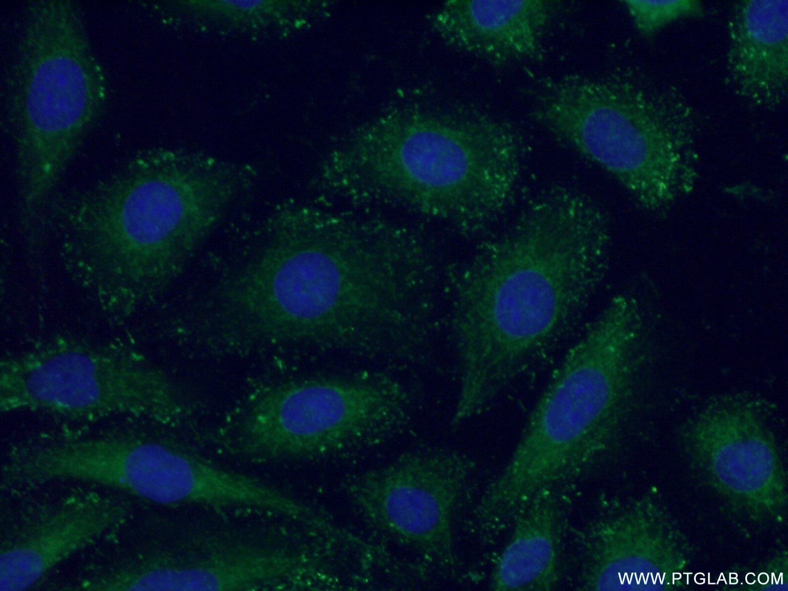Immunofluorescence (IF) / fluorescent staining of HUVEC cells using Piezo1 (extracellular domain) Polyclonal antibody (15939-1-AP)