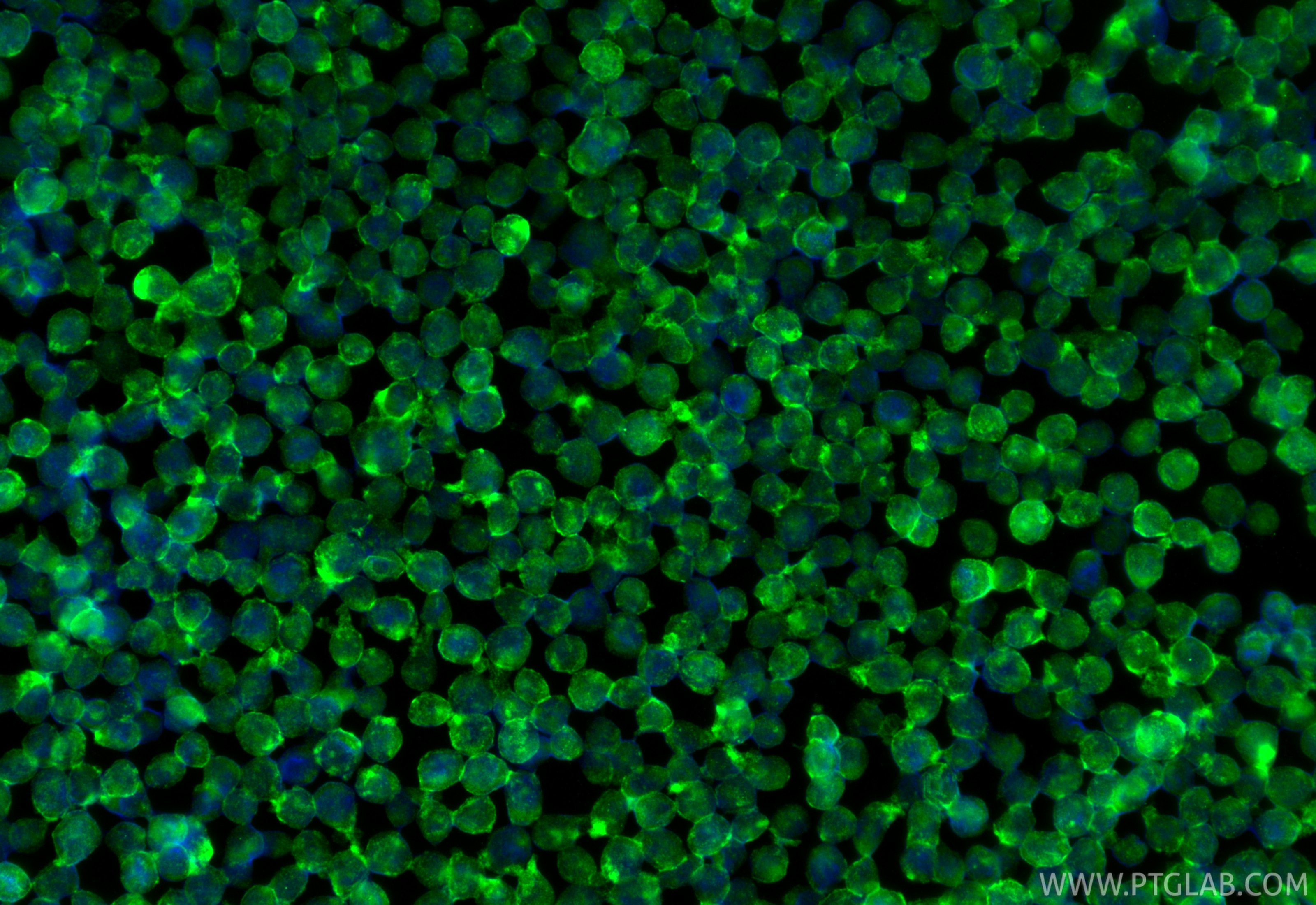 Immunofluorescence (IF) / fluorescent staining of THP-1 cells using Piezo1 (extracellular domain) Polyclonal antibody (15939-1-AP)