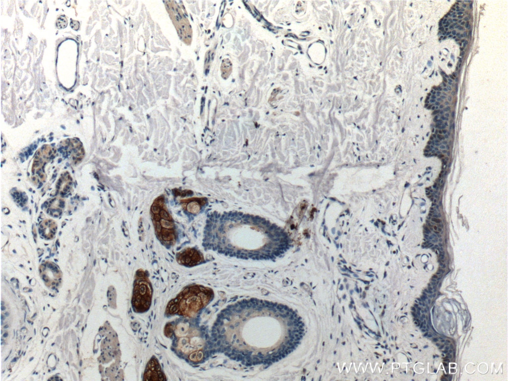 Immunohistochemistry (IHC) staining of human skin tissue using Piezo1 (extracellular domain) Polyclonal antibody (15939-1-AP)
