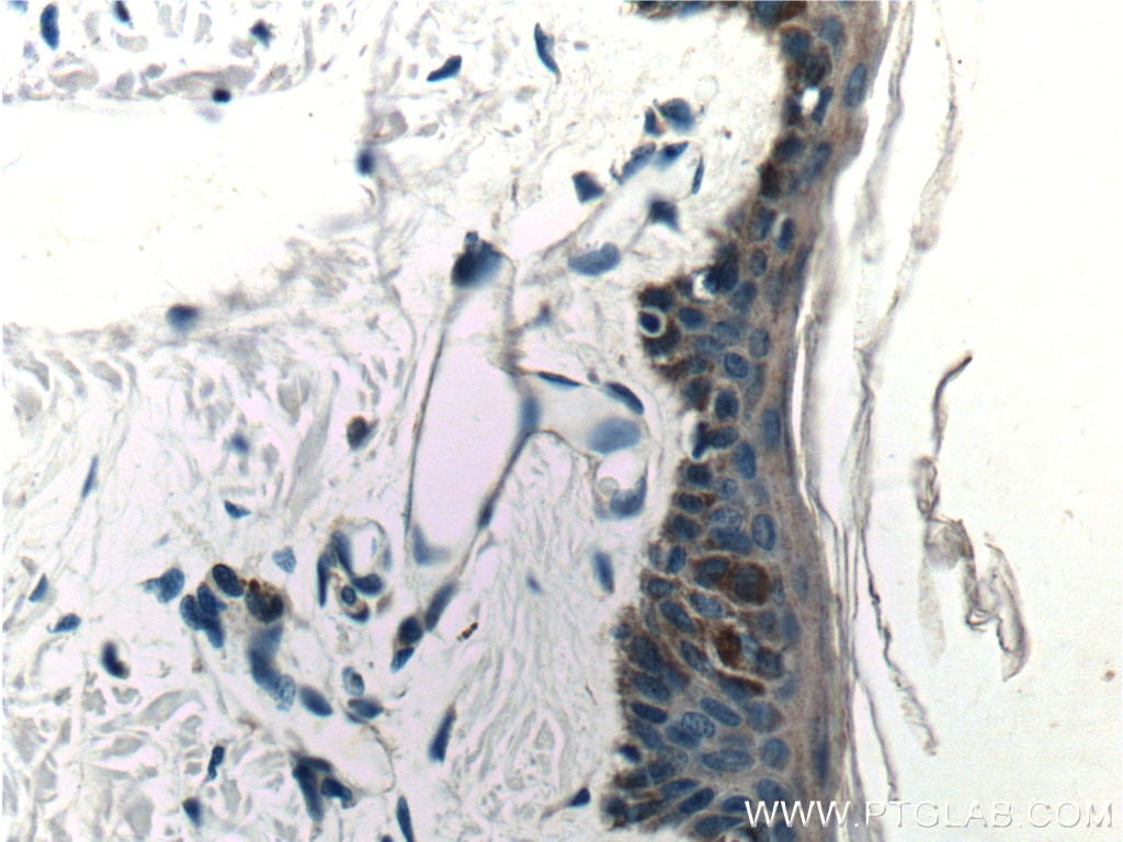 Immunohistochemistry (IHC) staining of human skin tissue using Piezo1 (extracellular domain) Polyclonal antibody (15939-1-AP)