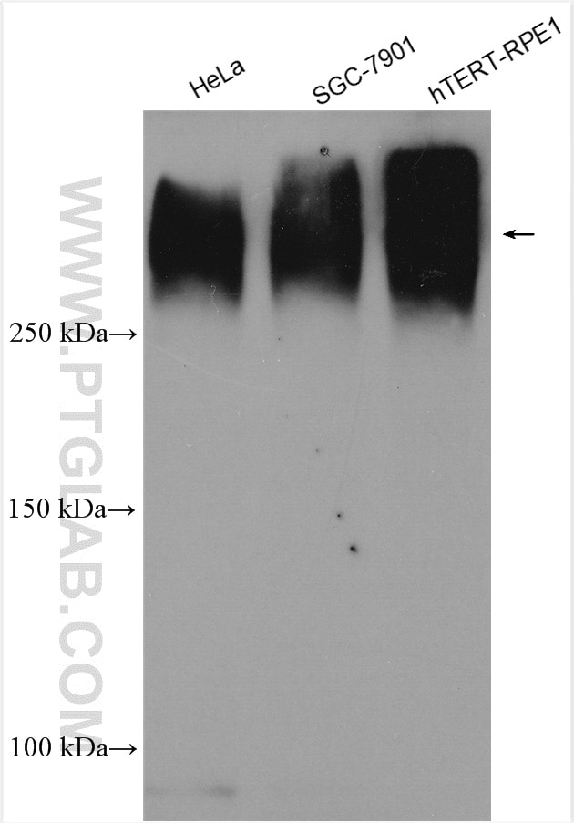 Western Blot (WB) analysis of various lysates using Piezo1 (extracellular domain) Polyclonal antibody (15939-1-AP)