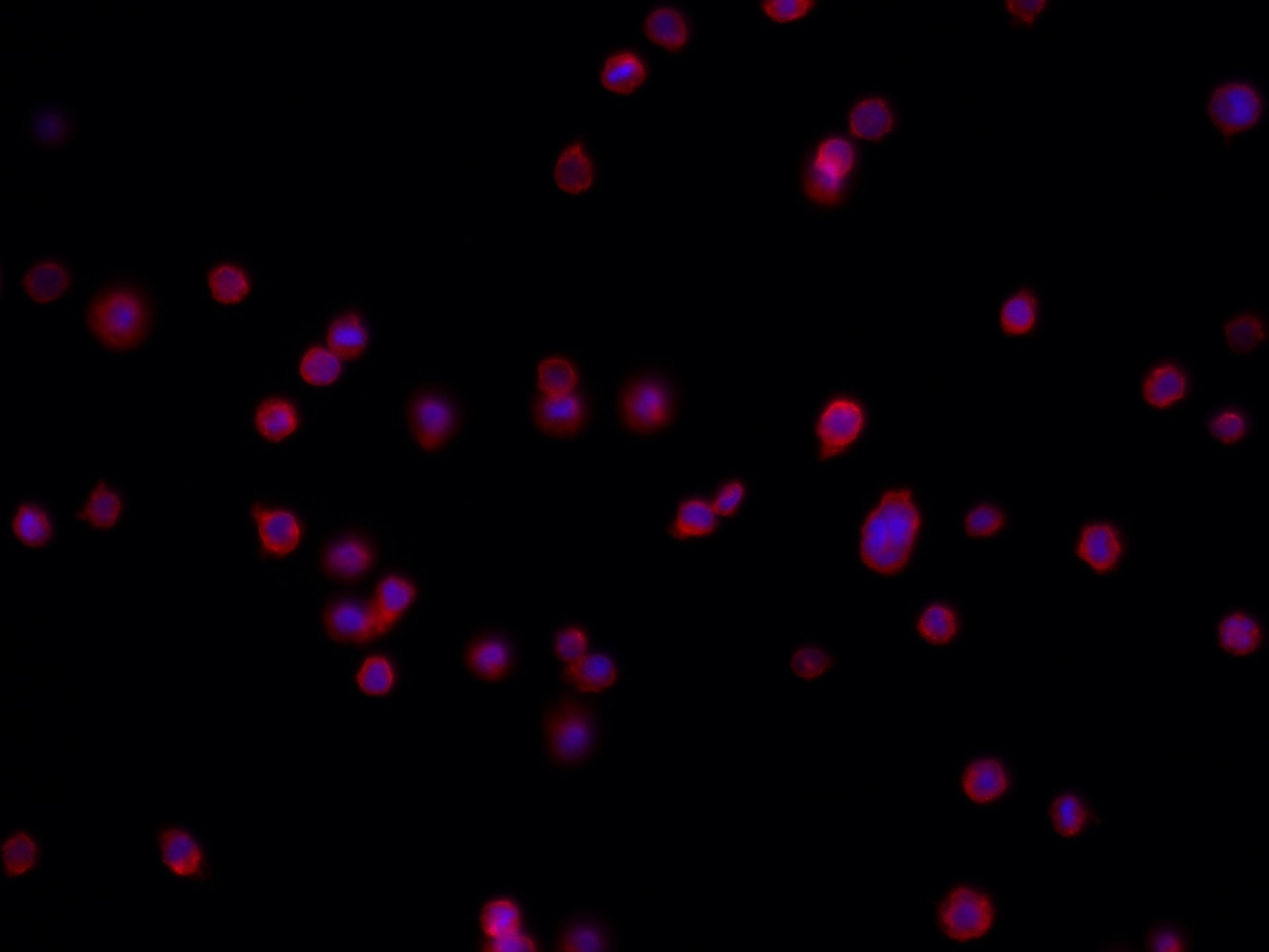 Immunofluorescence (IF) / fluorescent staining of THP-1 cells using Piezo1 (extracellular domain) Recombinant antibody (82625-4-RR)