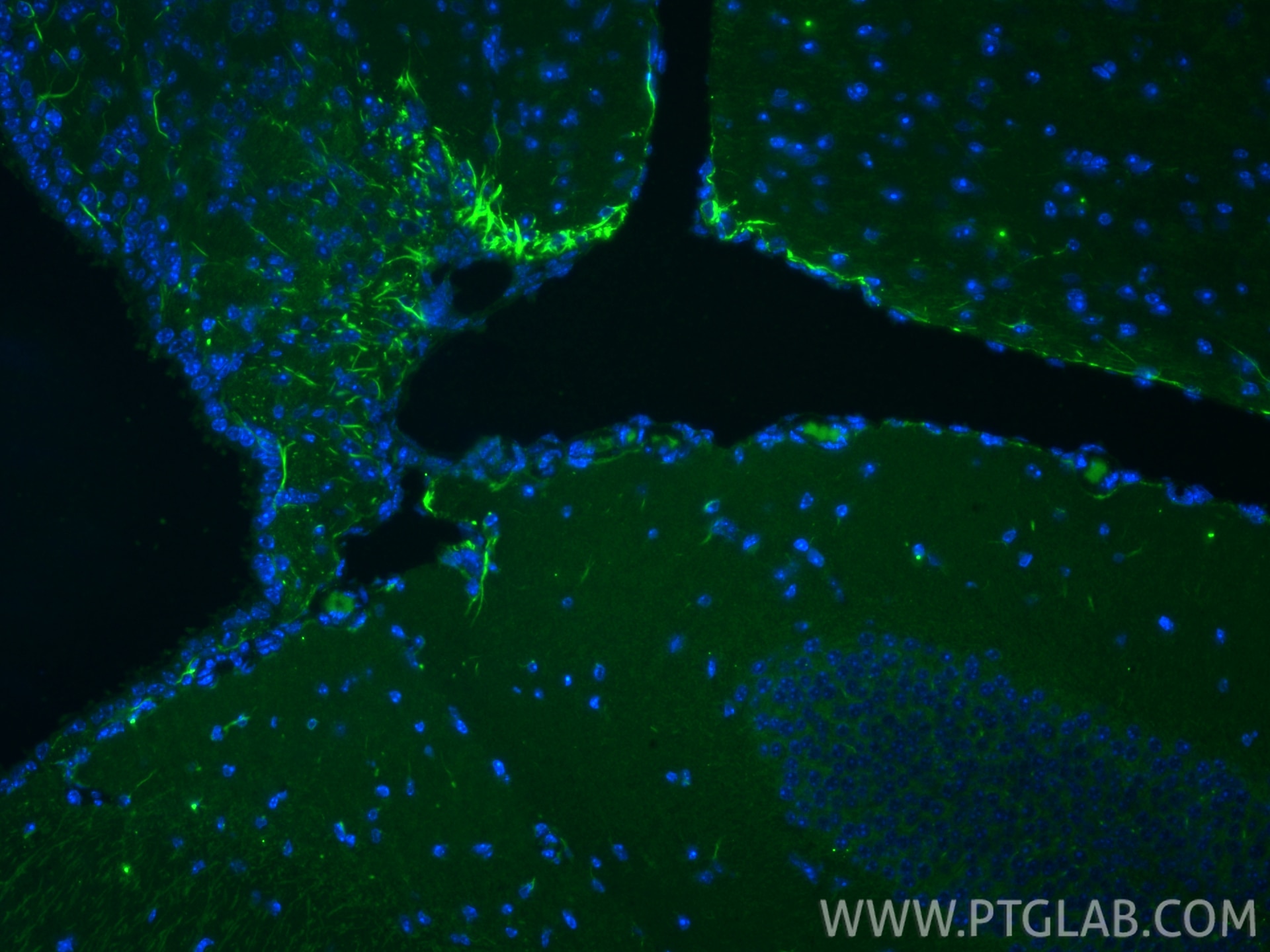 Immunofluorescence (IF) / fluorescent staining of mouse brain tissue using Piezo1 (extracellular domain) Recombinant monoclon (82625-4-RR)