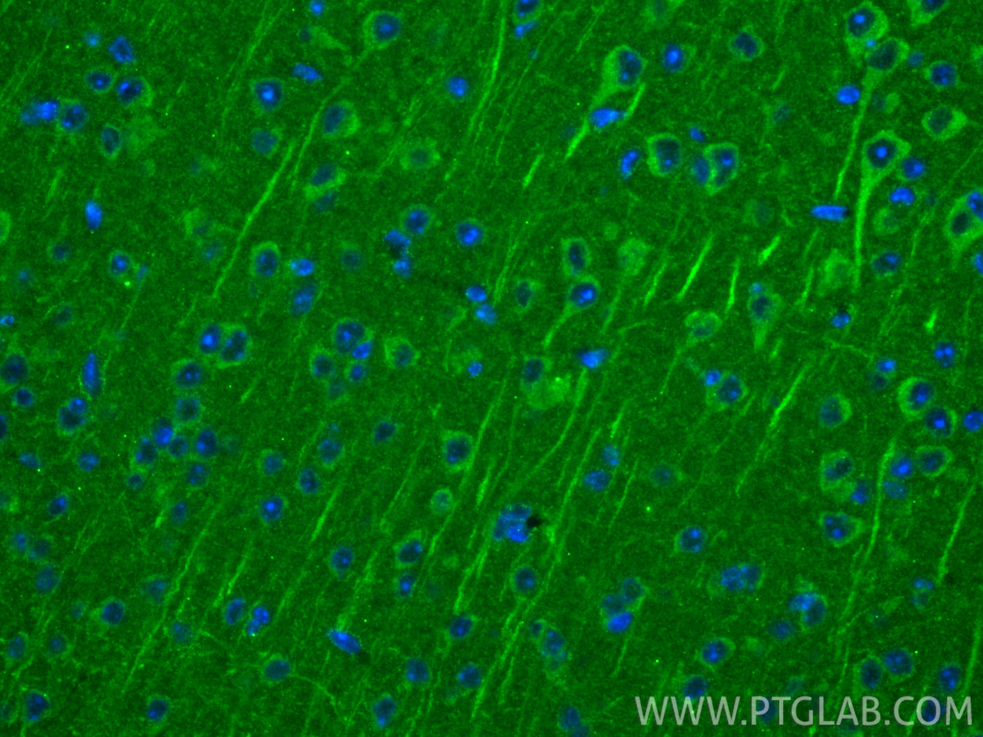 Immunofluorescence (IF) / fluorescent staining of mouse brain tissue using Piezo1 (extracellular domain) Recombinant monoclon (82625-4-RR)