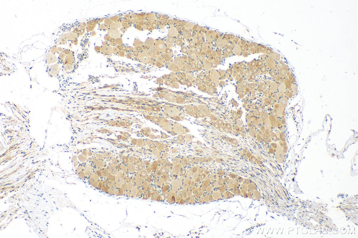 Immunohistochemistry (IHC) staining of rat dorsal root ganglion tissue using Piezo1 (extracellular domain) Recombinant antibody (82625-4-RR)
