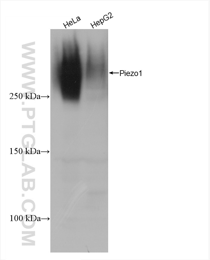 Western Blot (WB) analysis of various lysates using Piezo1 (extracellular domain) Recombinant antibody (82625-4-RR)