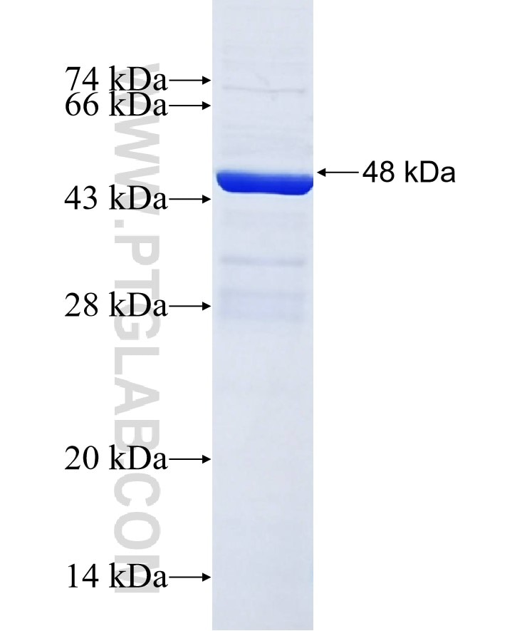 FAM38A fusion protein Ag29858 SDS-PAGE