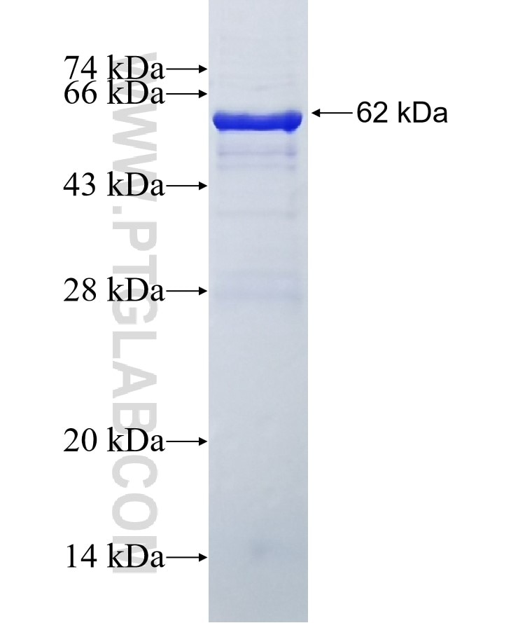 FAM38A fusion protein Ag7791 SDS-PAGE