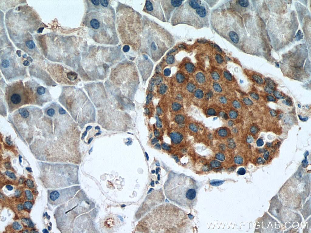 IHC staining of mouse pancreas using 20588-1-AP