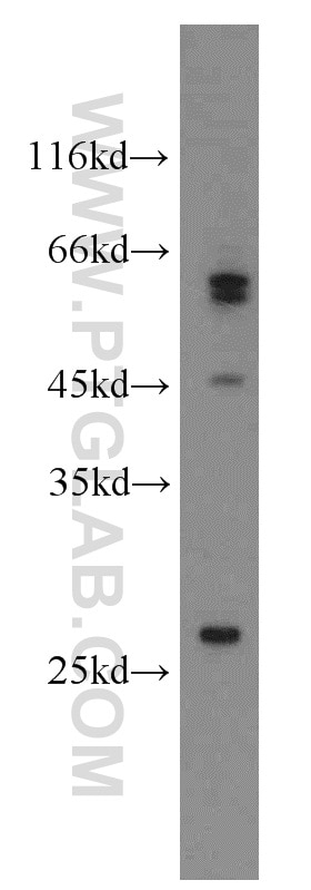 Western Blot (WB) analysis of PC-3 cells using FAM3B Polyclonal antibody (14043-1-AP)