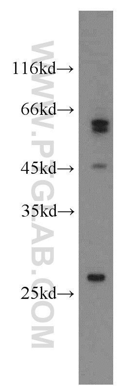 WB analysis of PC-3 using 14043-1-AP