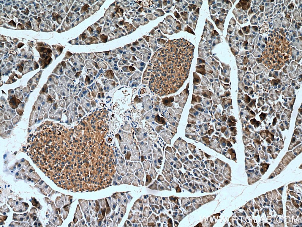 IHC staining of mouse pancreas using 27131-1-AP