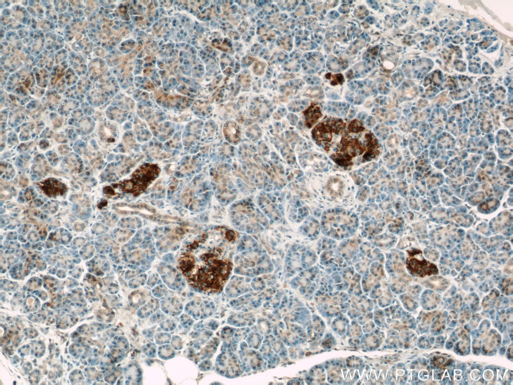 Immunohistochemistry (IHC) staining of human pancreas tissue using FAM3C Polyclonal antibody (14247-1-AP)