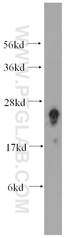 Western Blot (WB) analysis of human brain tissue using FAM3C Polyclonal antibody (14247-1-AP)