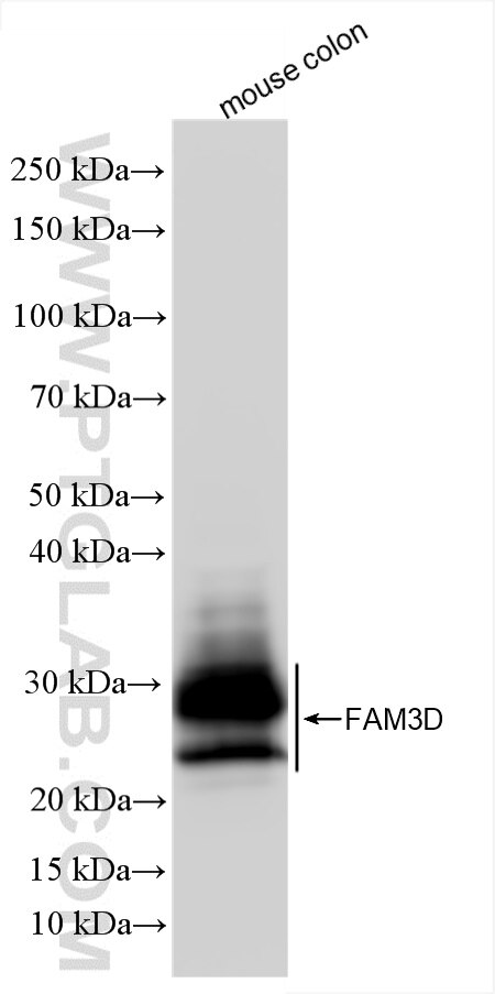 Western Blot (WB) analysis of various lysates using FAM3D Recombinant antibody (86090-2-RR)