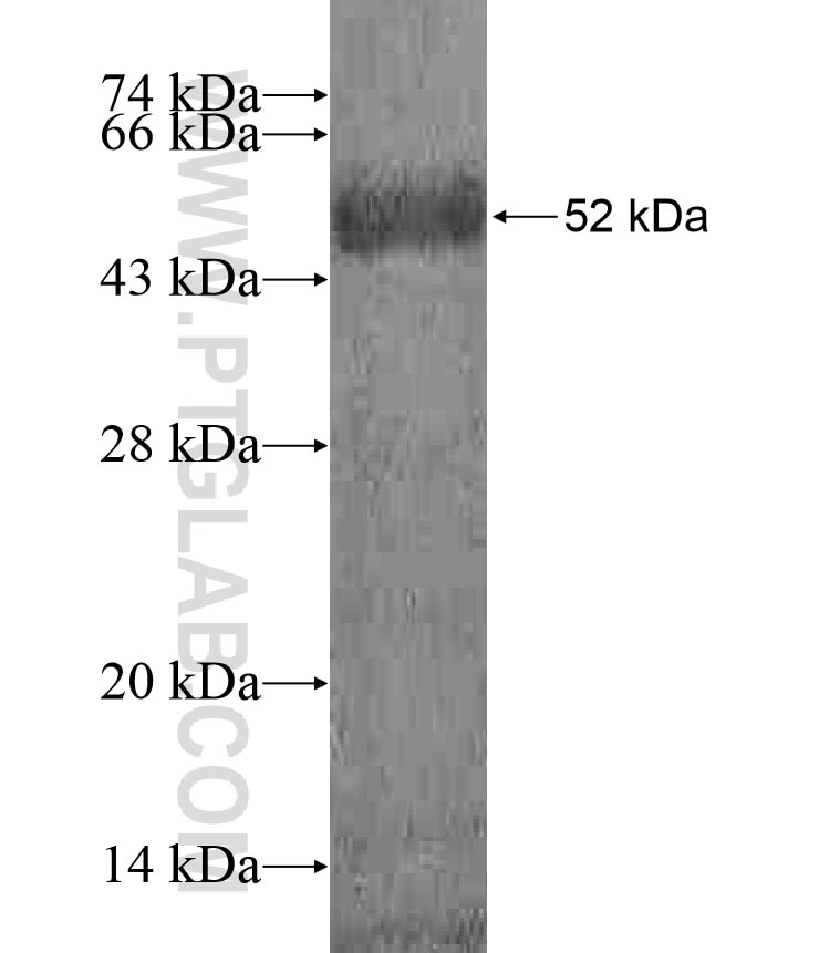 FAM40B fusion protein Ag18230 SDS-PAGE