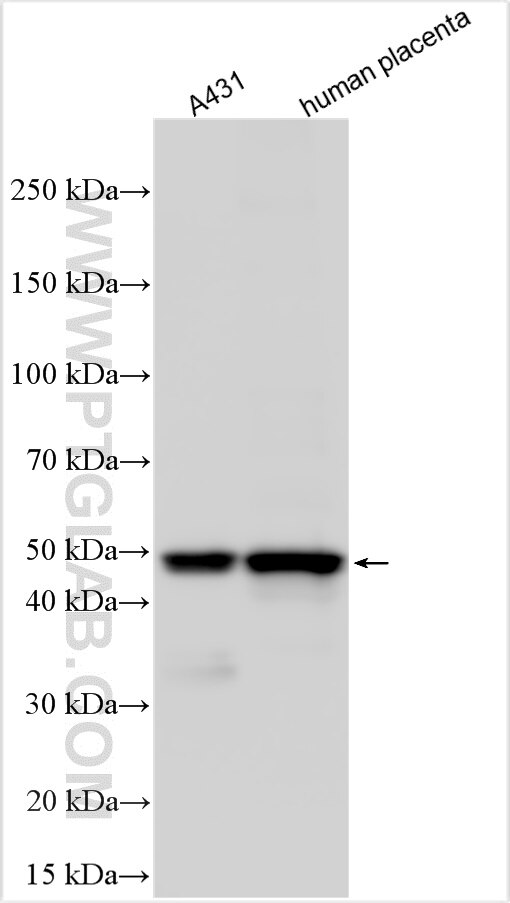 Western Blot (WB) analysis of various lysates using FAM46A Polyclonal antibody (31006-1-AP)