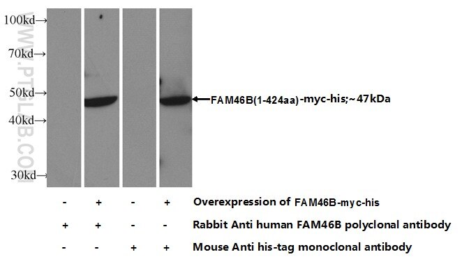 FAM46B