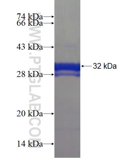 FAM46B fusion protein Ag19523 SDS-PAGE