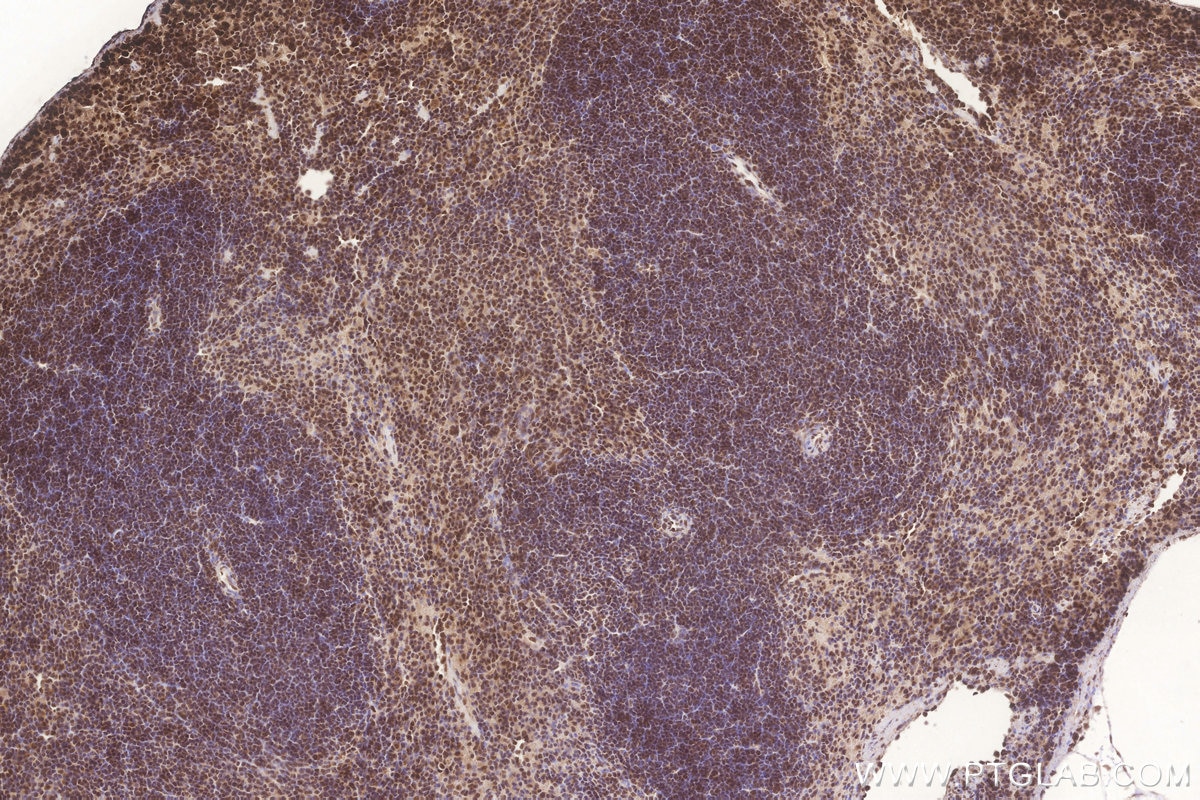 Immunohistochemistry (IHC) staining of mouse spleen tissue using FAM46C Polyclonal antibody (25038-1-AP)