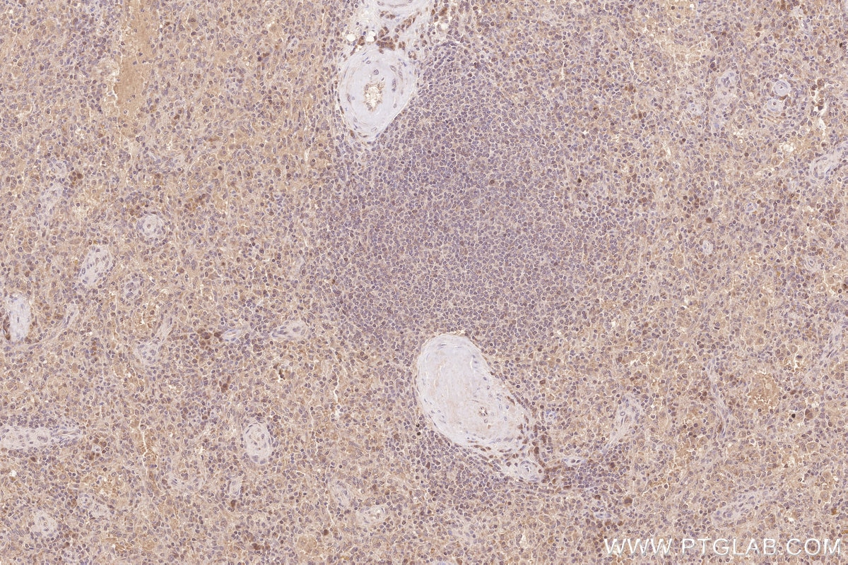 Immunohistochemistry (IHC) staining of human spleen tissue using FAM46C Polyclonal antibody (25038-1-AP)