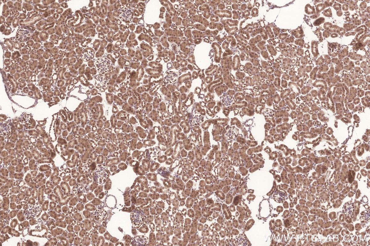 Immunohistochemistry (IHC) staining of mouse kidney tissue using FAM46C Polyclonal antibody (25038-1-AP)