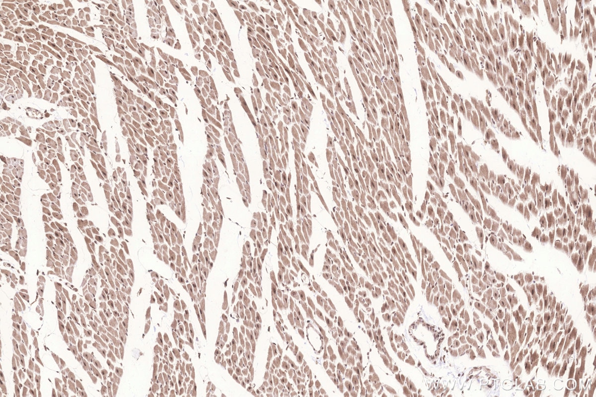 Immunohistochemistry (IHC) staining of rat heart tissue using FAM46C Polyclonal antibody (25038-1-AP)
