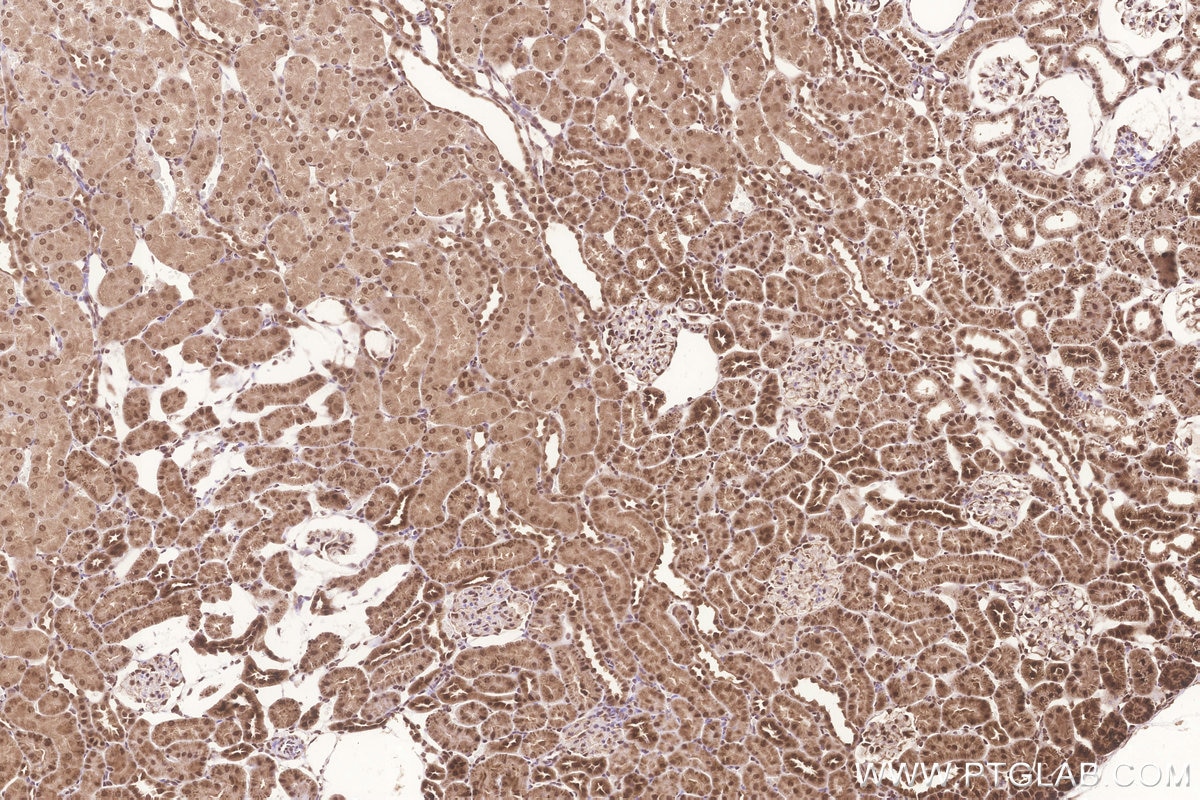 Immunohistochemistry (IHC) staining of rat kidney tissue using FAM46C Polyclonal antibody (25038-1-AP)