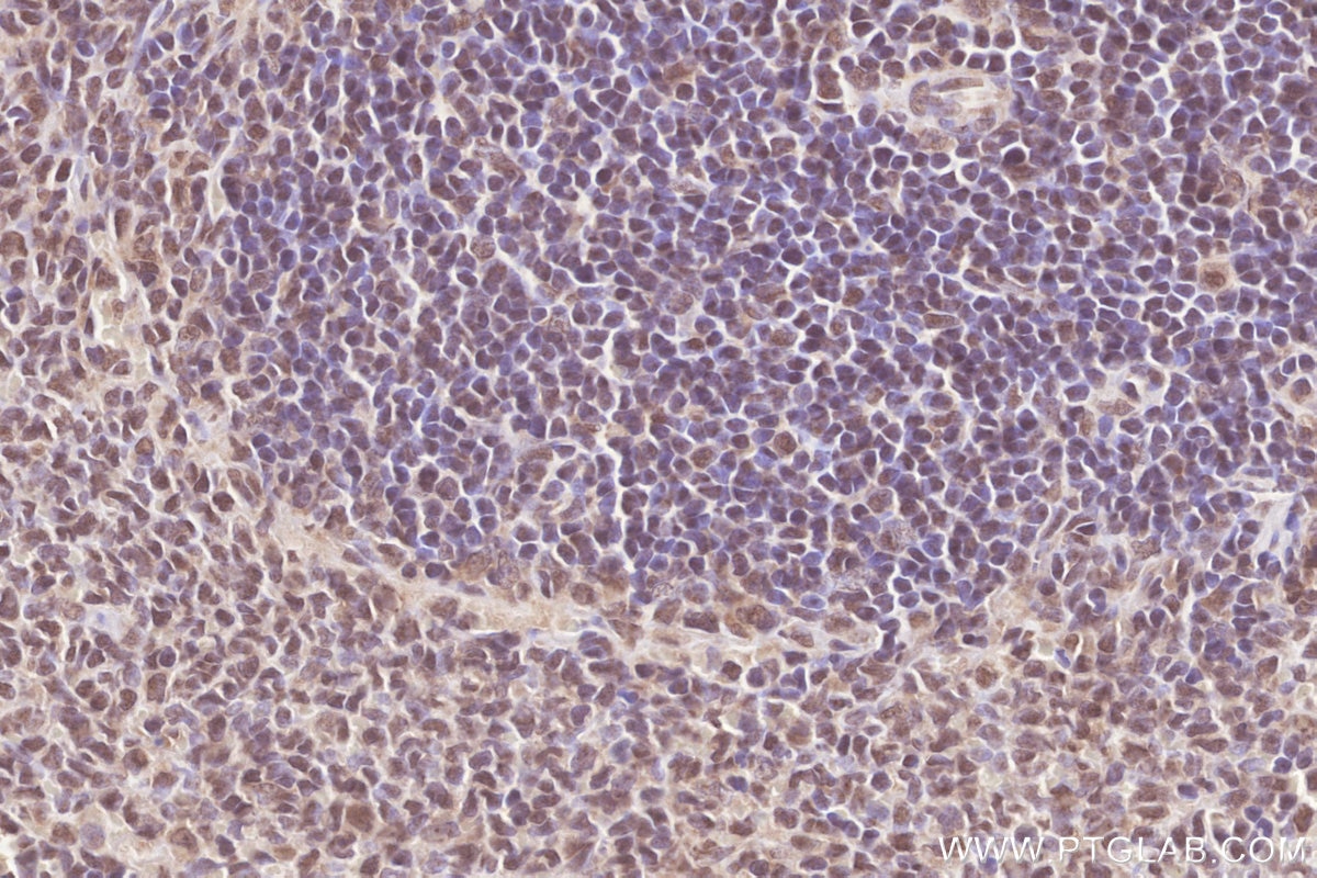 Immunohistochemistry (IHC) staining of rat spleen tissue using FAM46C Polyclonal antibody (25038-1-AP)