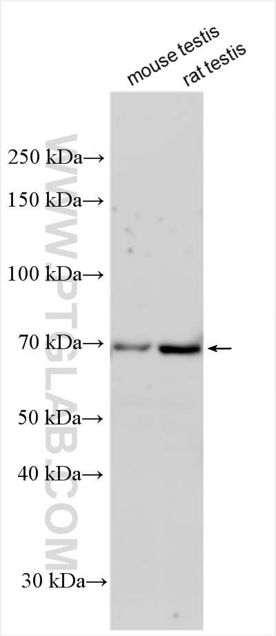 Western Blot (WB) analysis of various lysates using FAM47B Polyclonal antibody (24467-1-AP)