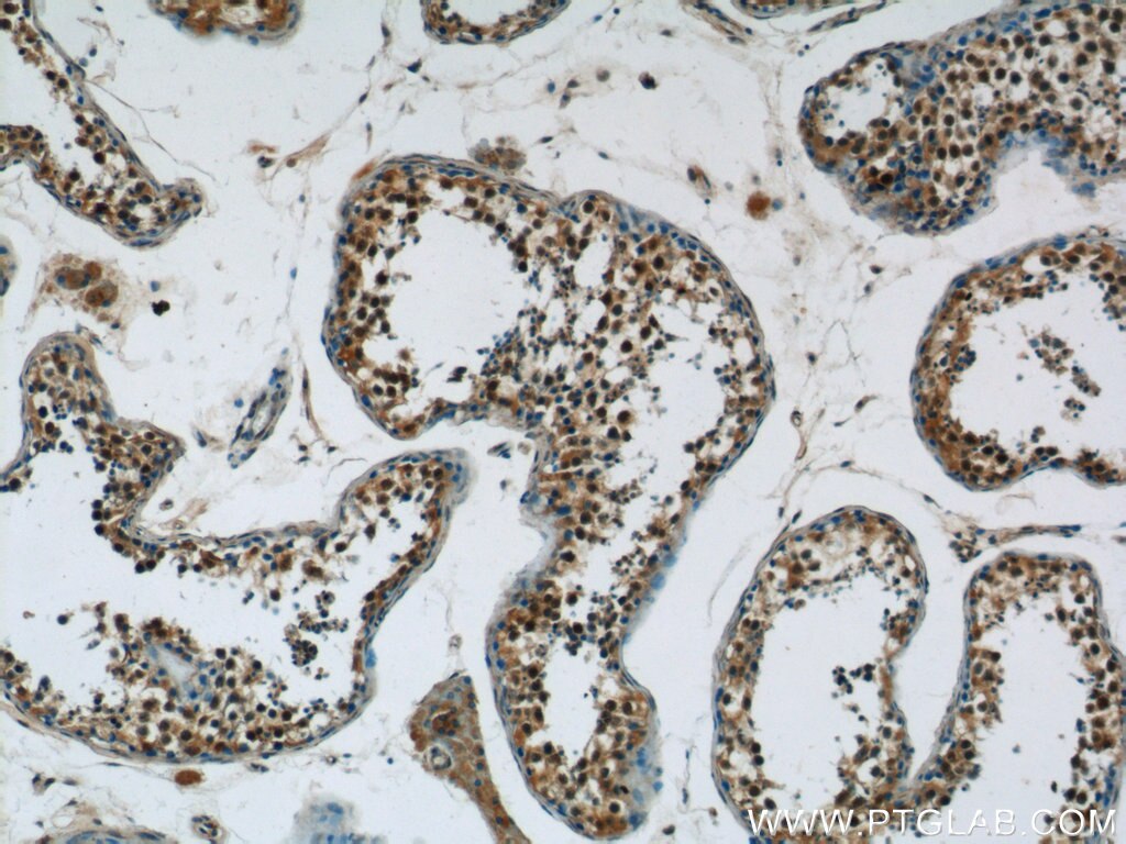 IHC staining of human testis using 24419-1-AP