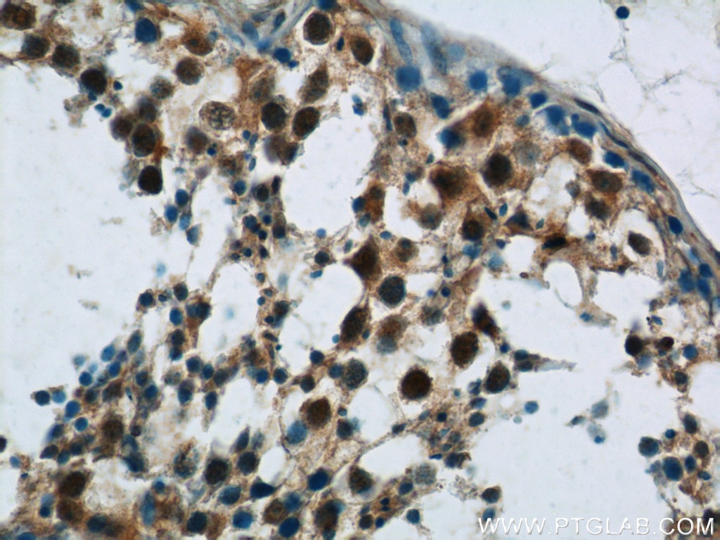 Immunohistochemistry (IHC) staining of human testis tissue using FAM48A Polyclonal antibody (24419-1-AP)