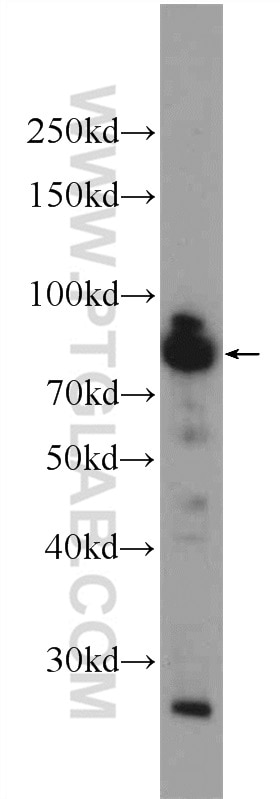 Western Blot (WB) analysis of Jurkat cells using FAM48A Polyclonal antibody (24419-1-AP)
