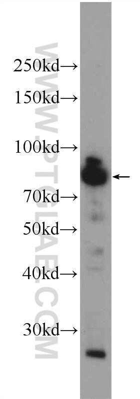 WB analysis of Jurkat using 24419-1-AP