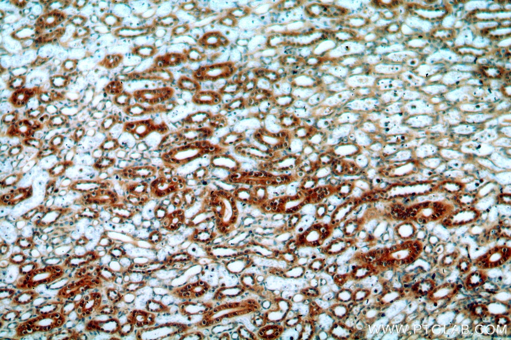 IHC staining of human kidney using 20127-1-AP