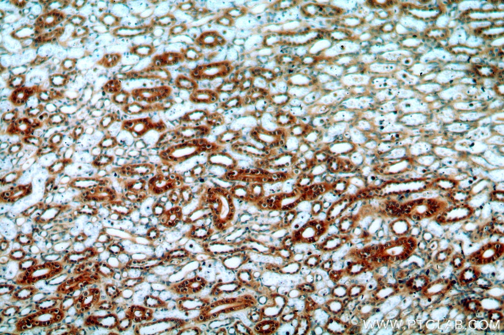 Immunohistochemistry (IHC) staining of human kidney tissue using FAM49B Polyclonal antibody (20127-1-AP)