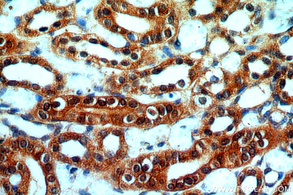 Immunohistochemistry (IHC) staining of human kidney tissue using FAM49B Polyclonal antibody (20127-1-AP)