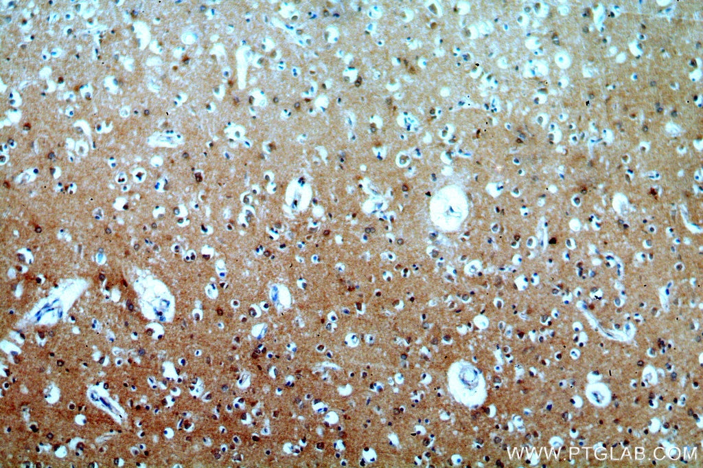Immunohistochemistry (IHC) staining of human brain tissue using FAM49B Polyclonal antibody (20127-1-AP)