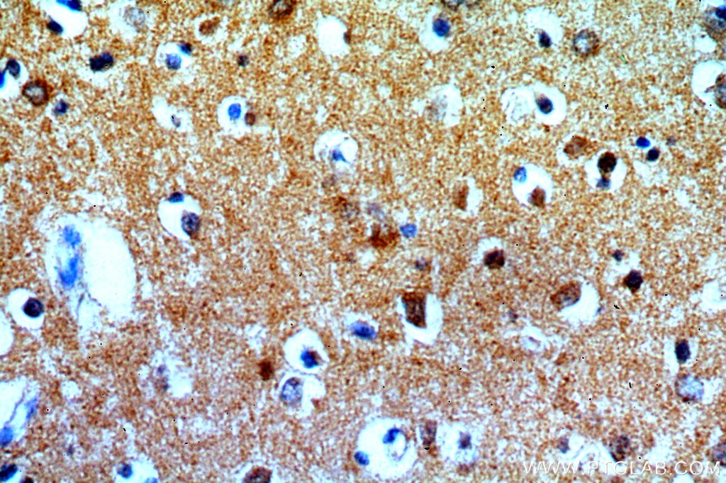 Immunohistochemistry (IHC) staining of human brain tissue using FAM49B Polyclonal antibody (20127-1-AP)