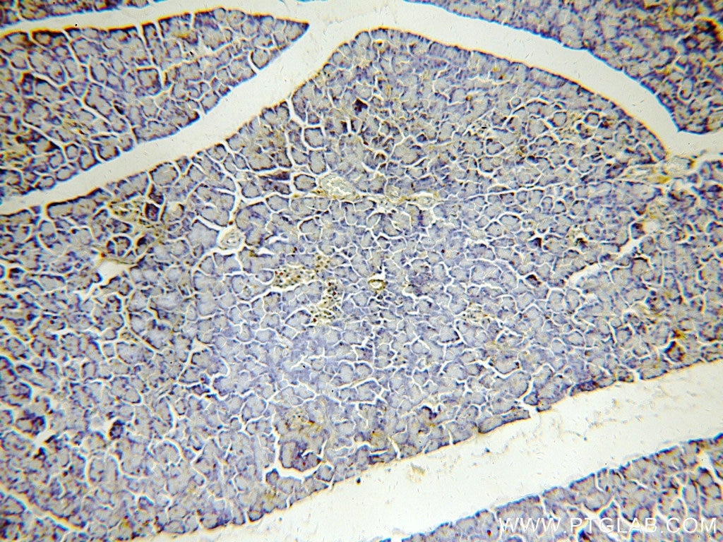 Immunohistochemistry (IHC) staining of human pancreas tissue using FAM49B Polyclonal antibody (20127-1-AP)