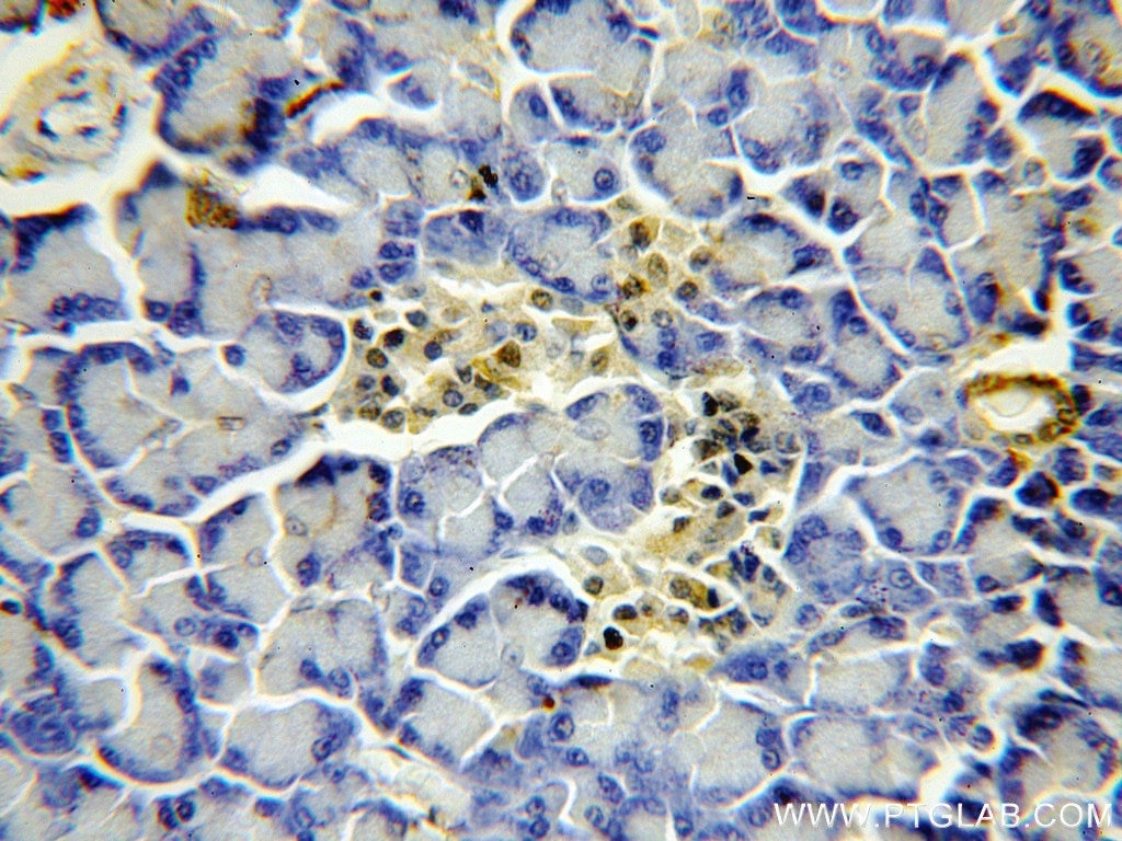 Immunohistochemistry (IHC) staining of human pancreas tissue using FAM49B Polyclonal antibody (20127-1-AP)