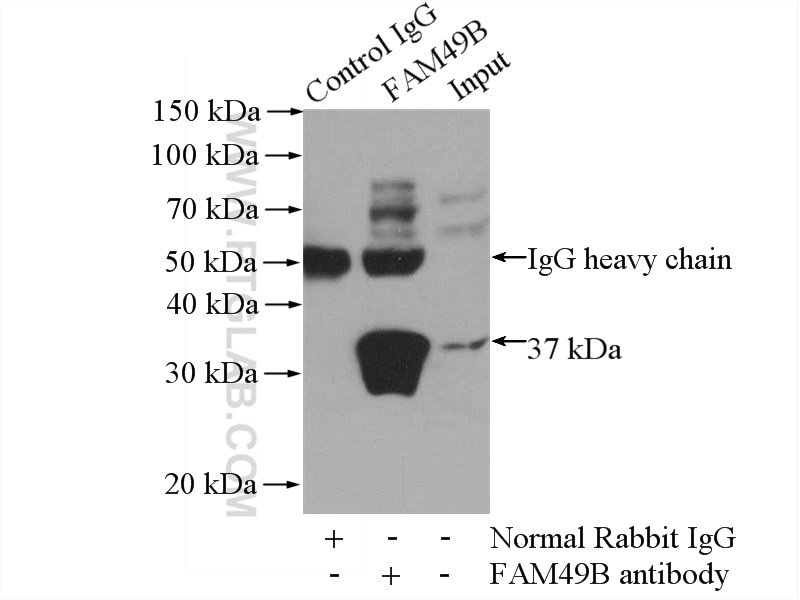 Immunoprecipitation (IP) experiment of mouse brain tissue using FAM49B Polyclonal antibody (20127-1-AP)