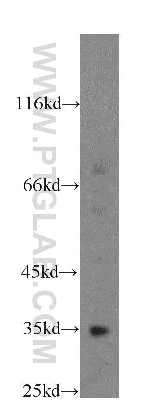 Western Blot (WB) analysis of mouse brain tissue using FAM49B Polyclonal antibody (20127-1-AP)