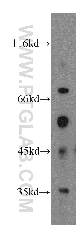 Western Blot (WB) analysis of human placenta tissue using FAM49B Polyclonal antibody (20127-1-AP)